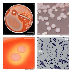 Composite laboratory image panel of Staphylococcus haemolyticus with preview photographs from the species overview page