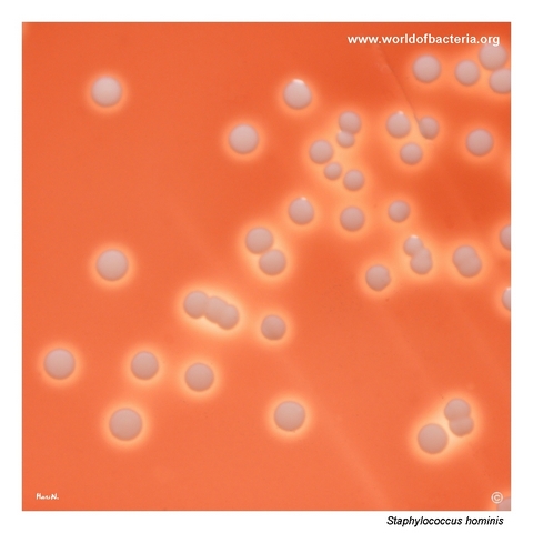Beta-haemolytic colonies of Staphylococcus hominis on blood agar