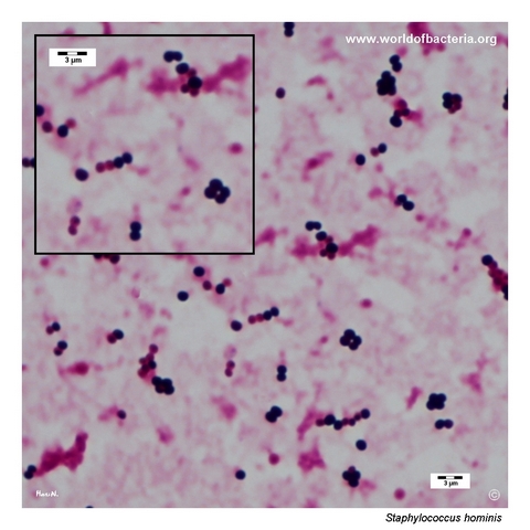 Gram-stained preparation from positive blood culture compatible with Staphylococcus hominis