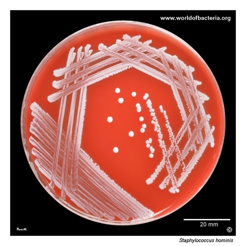 Staphylococcus hominis on blood agar after 24 hours of incubation