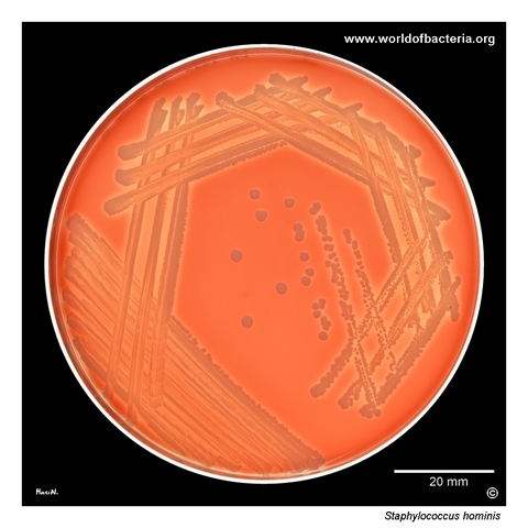 Variable haemolysis of Staphylococcus hominis colonies on blood agar