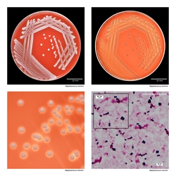 Composite laboratory image panel of Staphylococcus hominis with preview photographs from the species overview page