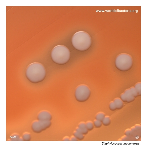 Yellow-tinged colonies of Staphylococcus lugdunensis with variable haemolysis