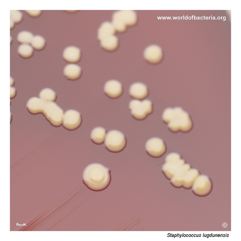 Conspicuously pigmented colonies of Staphylococcus lugdunensis on blood agar