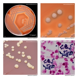 Composite laboratory image panel of Staphylococcus lugdunensis with preview photographs from the species overview page
