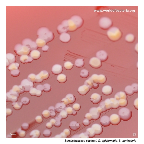 Mixed culture with Staphylococcus pasteuri, Staphylococcus epidermidis and Staphylococcus auricularis on blood agar