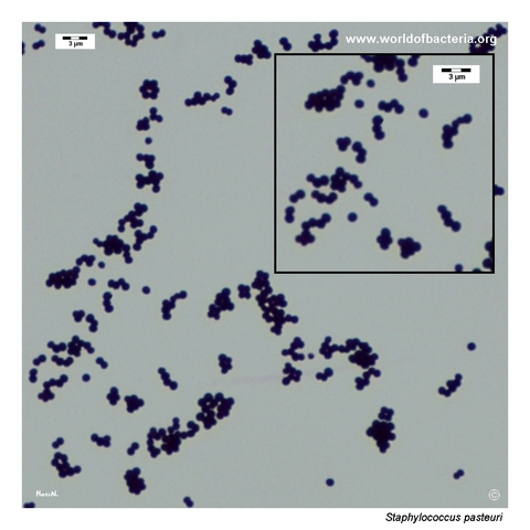 Gram-stained smear of Staphylococcus pasteuri from blood agar culture