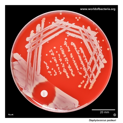 Subculture of yellow-pigmented Staphylococcus pasteuri on blood agar