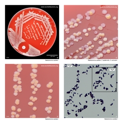 Composite laboratory image panel of Staphylococcus pasteuri with preview photographs from the species overview page