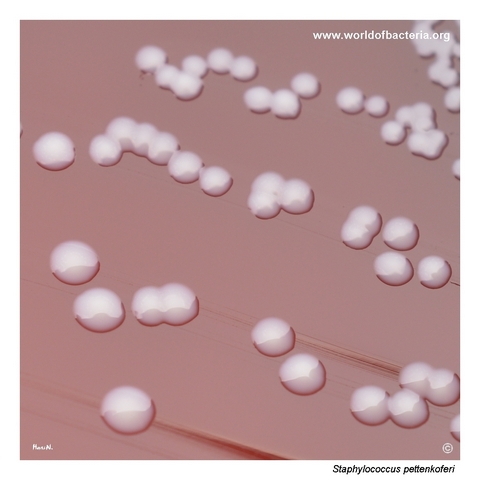 Typical non-pigmented colonies of Staphylococcus pettenkoferi on blood agar
