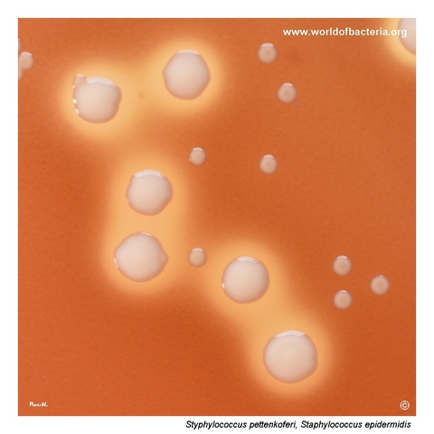 Small anaerobic colonies of Staphylococcus pettenkoferi on Schaedler agar with Staphylococcus epidermidis nearby