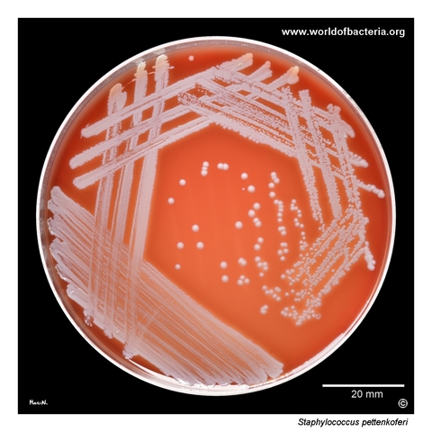 Staphylococcus pettenkoferi on blood agar from wound swab culture