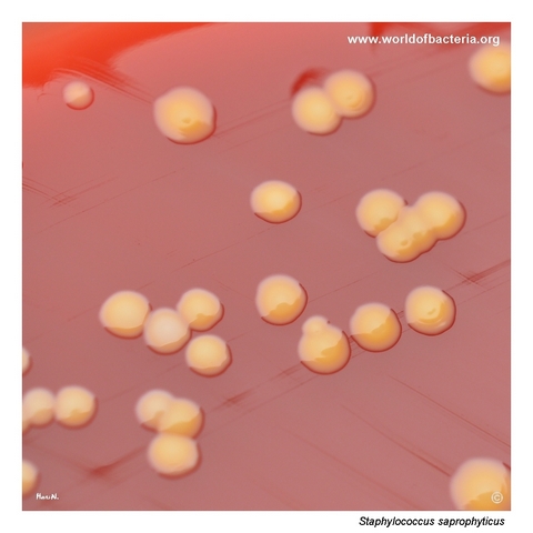 Pigmented but non-haemolytic colonies of Staphylococcus saprophyticus on blood agar