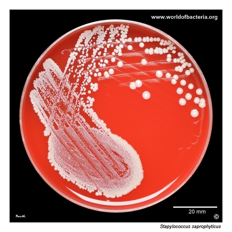 Large colonies of Staphylococcus saprophyticus on blood agar from a urine culture
