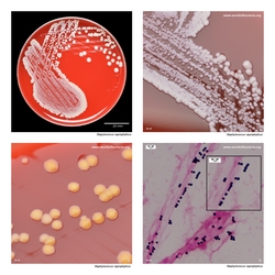 Composite laboratory image panel of Staphylococcus saprophyticus with preview photographs from the species overview page