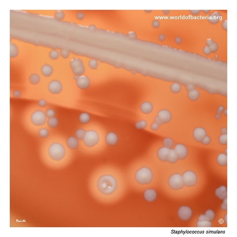 Haemolytic colonies of Staphylococcus simulans on blood agar