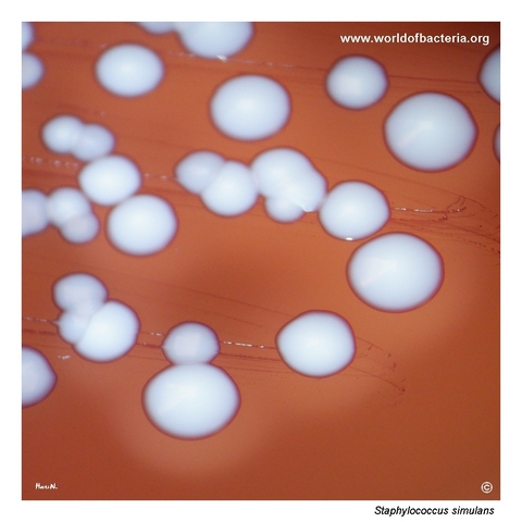 Close-up of beta-haemolytic colonies of Staphylococcus simulans on blood agar