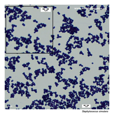 Gram-stained preparation of Staphylococcus simulans from blood agar culture