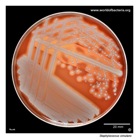 Subculture of Staphylococcus simulans from enrichment broth on blood agar