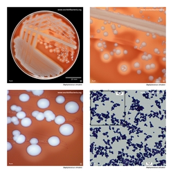 Composite laboratory image panel of Staphylococcus simulans with preview photographs from the species overview page