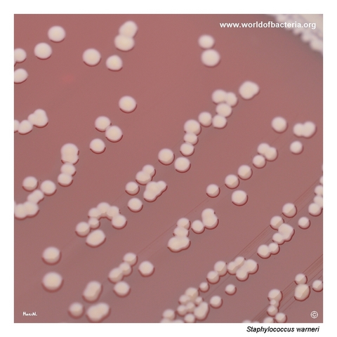 Typical smooth convex grey-white colonies of Staphylococcus warneri with faint yellowish tint