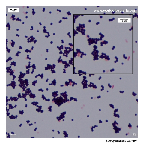 Gram-stained smear from a colony of Staphylococcus warneri