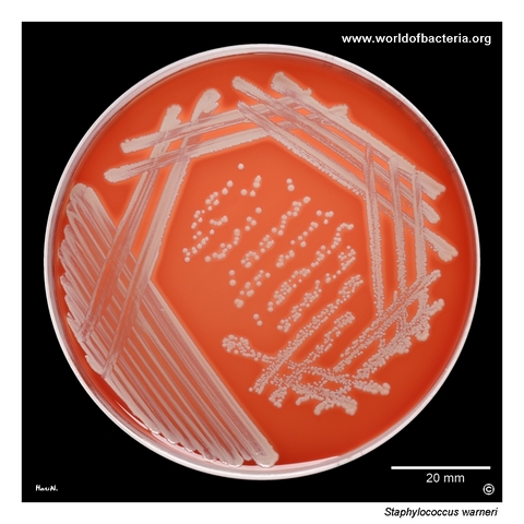 Pure culture of Staphylococcus warneri on blood agar