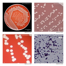 Composite laboratory image panel of Staphylococcus warneri with preview photographs from the species overview page