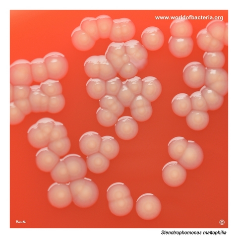 Yellow-pigmented Stenotrophomonas maltophilia colonies with a slightly uneven surface on blood agar