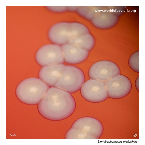 Close-up of non-haemolytic umbonate Stenotrophomonas maltophilia colonies with yellow centres