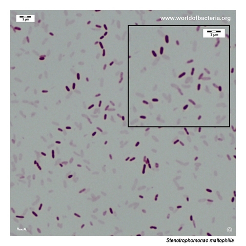 Gram-stained smear showing Gram-negative Stenotrophomonas maltophilia rods