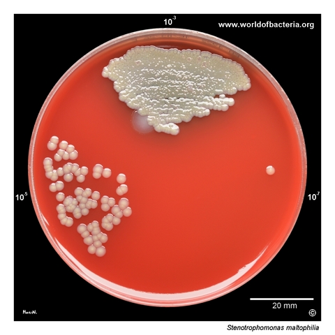Stenotrophomonas maltophilia recovered from diluted sputum culture with a Pseudomonas aeruginosa colony