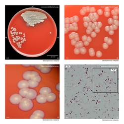 Composite laboratory image panel of Stenotrophomonas maltophilia with preview photographs from the species overview page