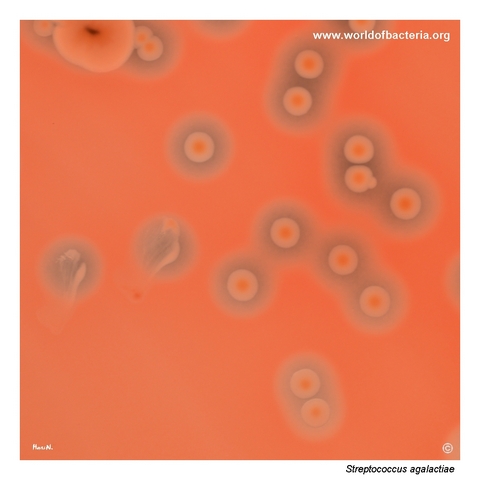 Beta-haemolytic colonies of Streptococcus agalactiae with yellow-orange pigmentation on blood agar