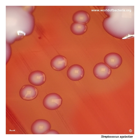 Close-up of pigmented beta-haemolytic Streptococcus agalactiae colonies on blood agar