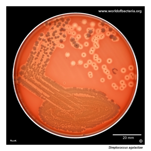 Mixed urine culture with beta-haemolytic Streptococcus agalactiae and non-haemolytic Escherichia coli on blood agar