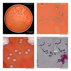 Composite laboratory image panel of Streptococcus agalactiae with preview photographs from the species overview page