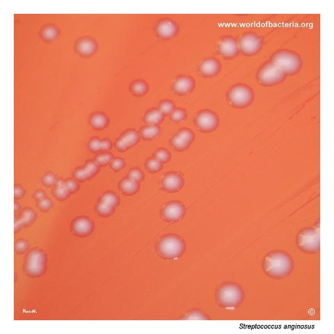 Small non-haemolytic colonies of Streptococcus anginosus on blood agar