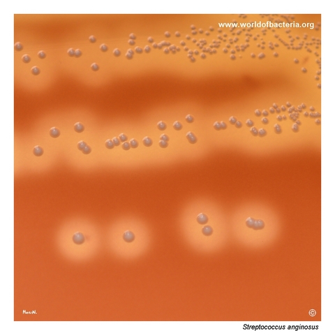 Beta-haemolytic colonies of Streptococcus anginosus on blood agar