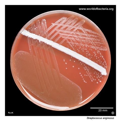 Streptococcus anginosus subcultured from enrichment broth on blood agar from gallbladder pus