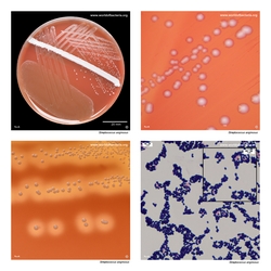 Composite laboratory image panel of Streptococcus anginosus with preview photographs from the species overview page