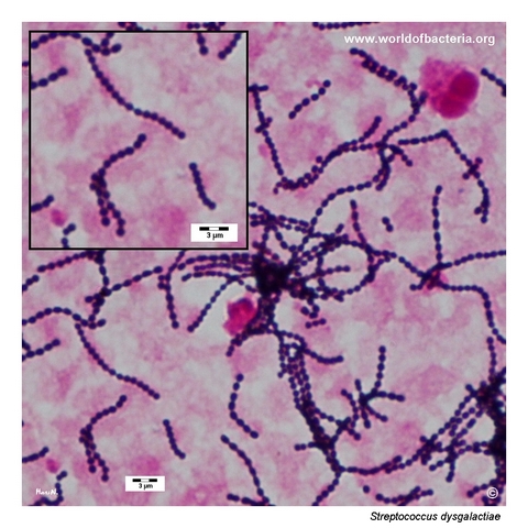 Positive blood culture smear showing long chains of Streptococcus dysgalactiae