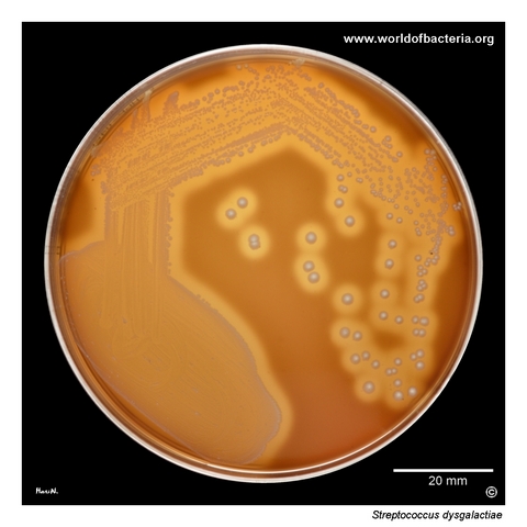 Beta-haemolytic Streptococcus dysgalactiae colonies on blood agar from a positive blood culture isolate