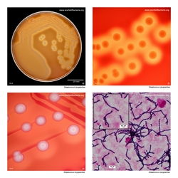 Composite laboratory image panel of Streptococcus dysgalactiae with preview photographs from the species overview page