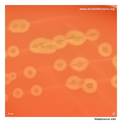 Irregular alpha-haemolytic colonies of Streptococcus mitis on blood agar