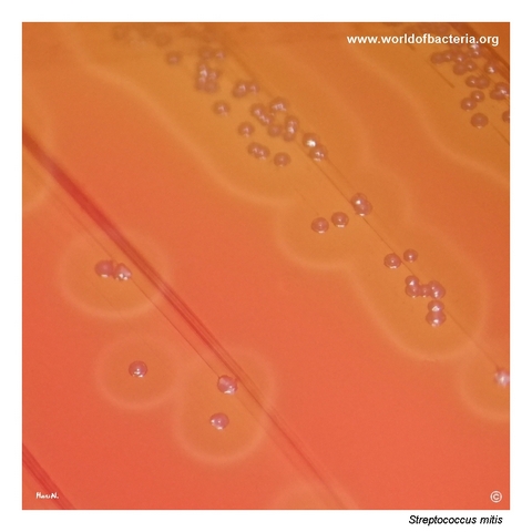Umbonate alpha-haemolytic colonies of Streptococcus mitis on blood agar