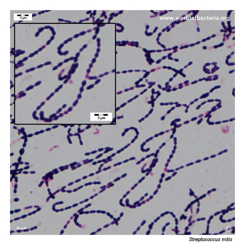 Gram-stained smear of Streptococcus mitis showing diplococci and short chains