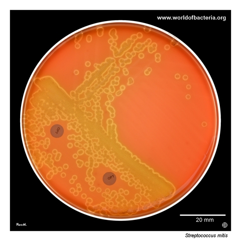 Streptococcus mitis on blood agar showing alpha-haemolytic colonies and optochin resistance