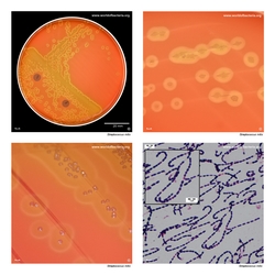Composite laboratory image panel of Streptococcus mitis with preview photographs from the species overview page