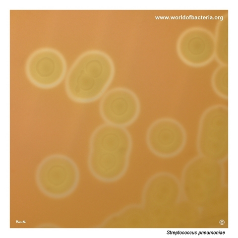 Alpha-haemolytic colonies of Streptococcus pneumoniae ATCC 49619 on blood agar
